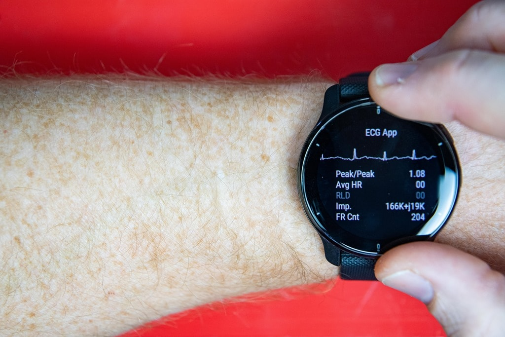 Garmin ECG smartwatch